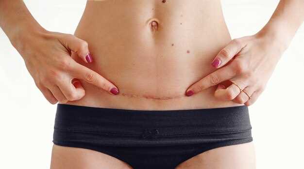 Как правильно ухаживать за рубцами